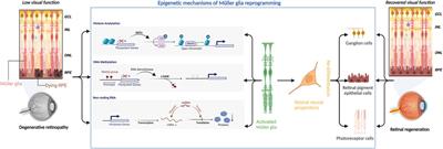 Epigenetic mechanisms of Müller glial reprogramming mediating retinal regeneration